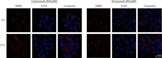 Comparison of HER2-Targeted Antibodies for Fluorescence-Guided Surgery in Breast Cancer.