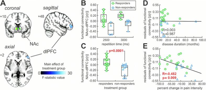 Pain stickiness in pediatric complex regional pain syndrome: A role for the nucleus accumbens