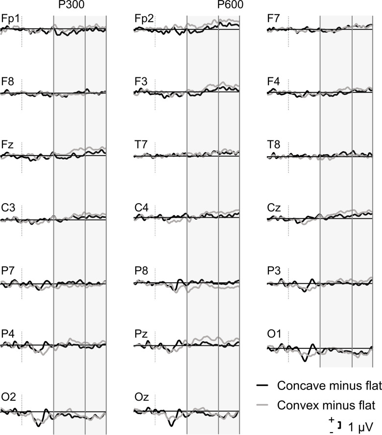 State anxiety influences P300 and P600 event-related potentials over parietal regions in the hollow-mask illusion experiment.