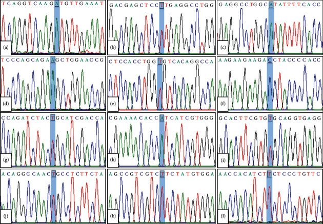 Genotype-Phenotype Correlation of G6PD Mutations among Central Thai Children with G6PD Deficiency.