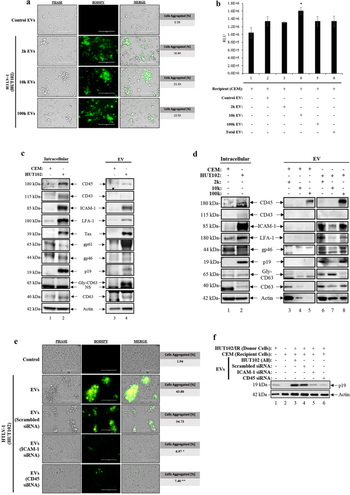 Extracellular vesicles from HTLV-1 infected cells modulate target cells and viral spread.