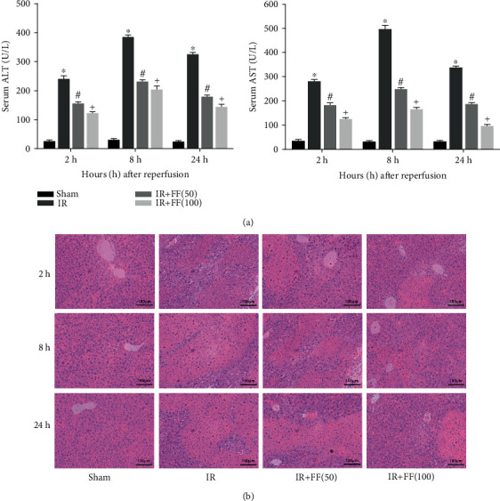 Fenofibrate Ameliorates Hepatic Ischemia/Reperfusion Injury in Mice: Involvements of Apoptosis, Autophagy, and PPAR-<i>α</i> Activation.