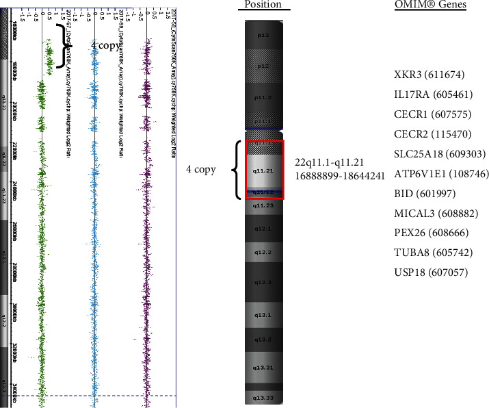 A De Novo sSMC (22) Characterized by High-Resolution Chromosome Microarray Analysis in a Chinese Boy with Cat-Eye Syndrome.