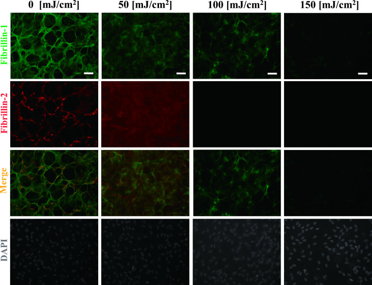 Matrix Metalloproteinase-2 Activated by Ultraviolet-B Degrades Human Ciliary Zonules <i>In Vitro</i>.