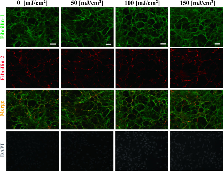 Matrix Metalloproteinase-2 Activated by Ultraviolet-B Degrades Human Ciliary Zonules <i>In Vitro</i>.