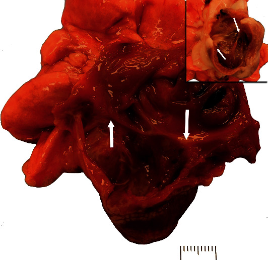 Right Atrioventricular Valvular Dysplasia in a New Zealand White Rabbit.