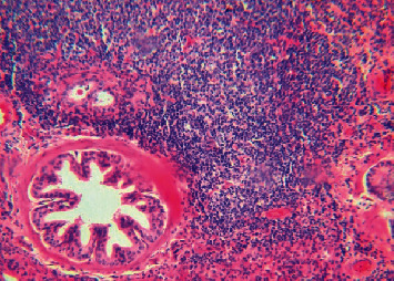 Ovine Progressive Pneumonia: Diagnosis and Seroprevalence in the South of Sonora, Mexico.