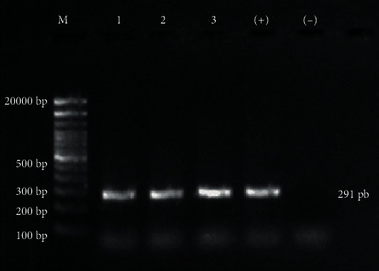 Ovine Progressive Pneumonia: Diagnosis and Seroprevalence in the South of Sonora, Mexico.