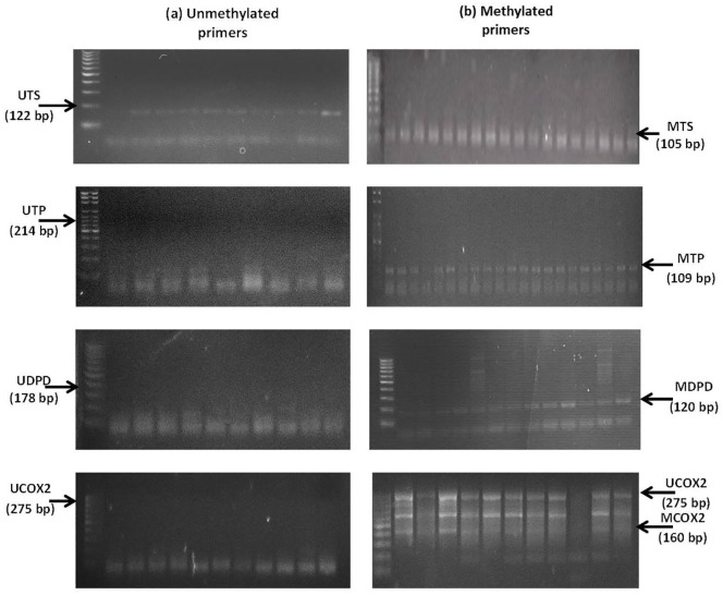 The Clinical Significance of Promoter Methylation of Fluoropyrimidine Metabolizing and Cyclooxygenase Genes in Colorectal Cancer.