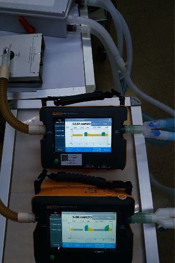 Combined Ventilation of Two Subjects with a Single Mechanical Ventilator Using a New Medical Device: An In Vitro Study.