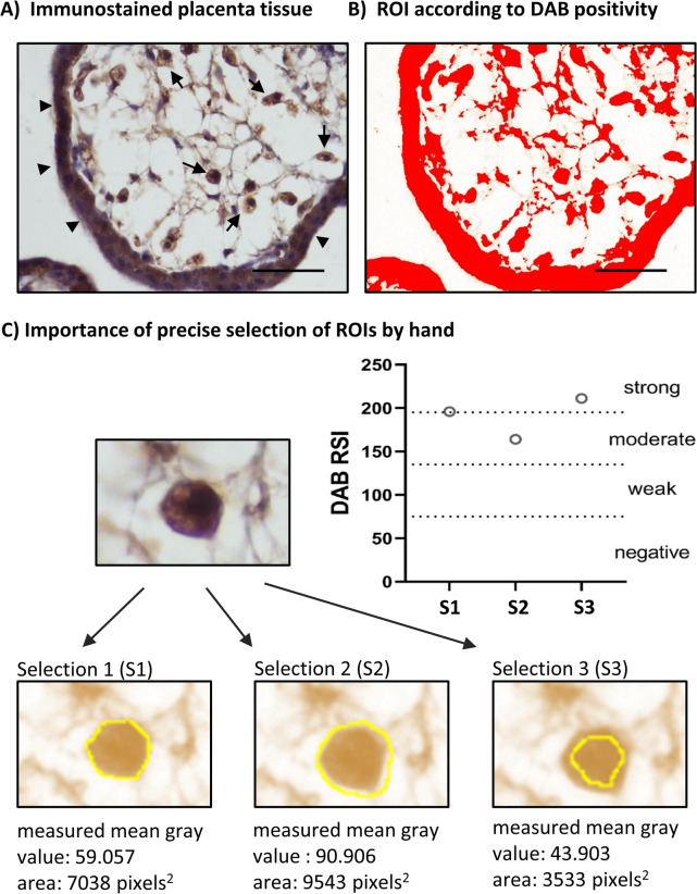 Comparative Analysis of Immunohistochemical Staining Intensity Determined by Light Microscopy, ImageJ and QuPath in Placental Hofbauer Cells.