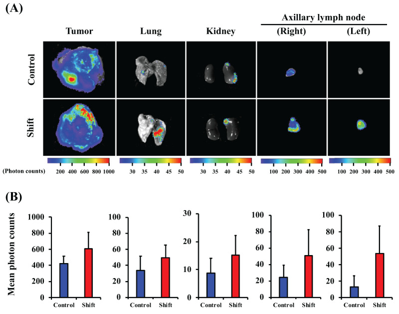 Metastasis of Breast Cancer Promoted by Circadian Rhythm Disruption due to Light/Dark Shift and its Prevention by Dietary Quercetin in Mice.