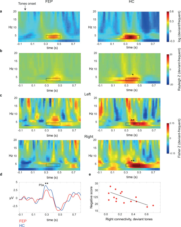 Impairment of novelty-related theta oscillations and P3a in never medicated first-episode psychosis patients.