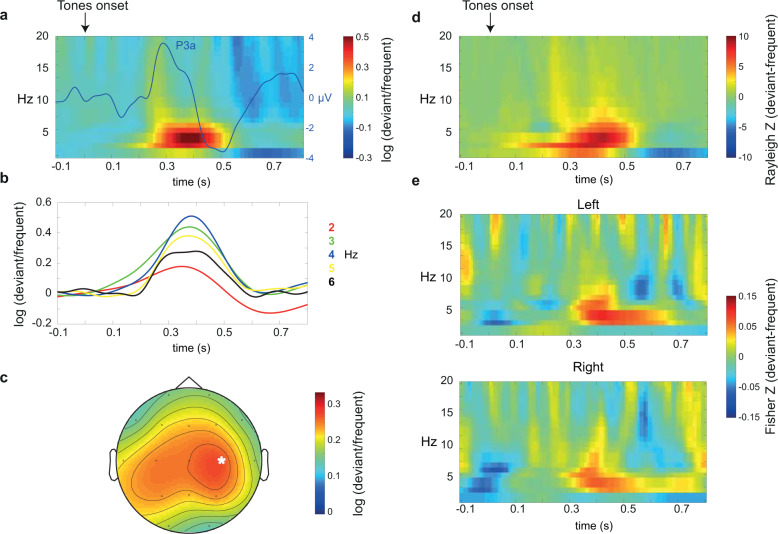 Impairment of novelty-related theta oscillations and P3a in never medicated first-episode psychosis patients.