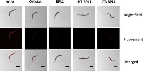 Lipoteichoic acid from Bifidobacterium animalis subsp. lactis BPL1: a novel postbiotic that reduces fat deposition via IGF-1 pathway