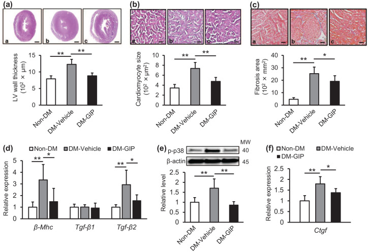 Glucose-dependent insulinotropic polypeptide inhibits cardiac hypertrophy and fibrosis in diabetic mice via suppression of TGF-β2.