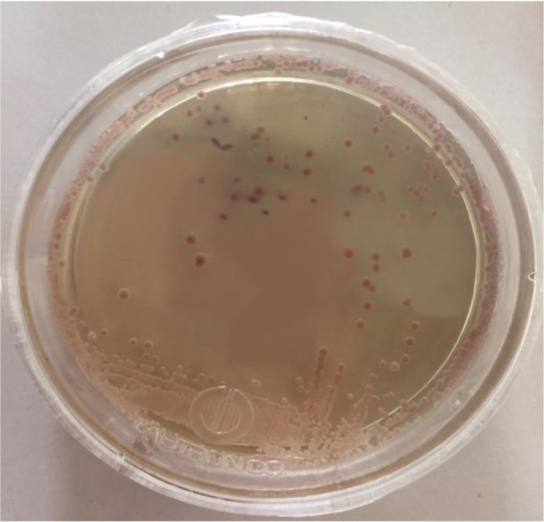 First fluconazole-resistant <i>Candida auris</i> isolated from fungal otitis in Iran.