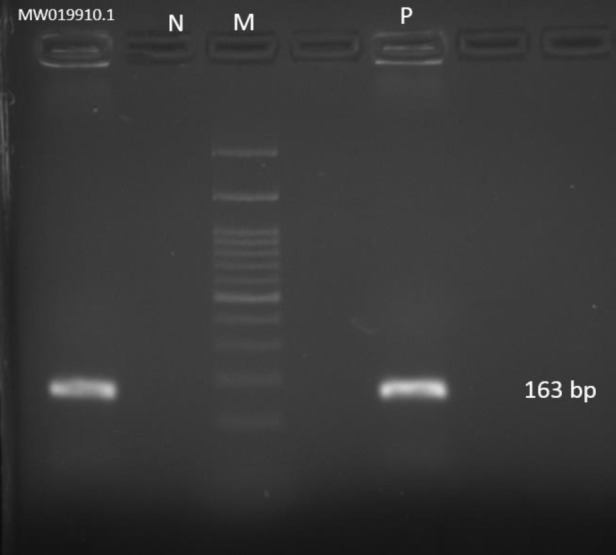 First fluconazole-resistant <i>Candida auris</i> isolated from fungal otitis in Iran.