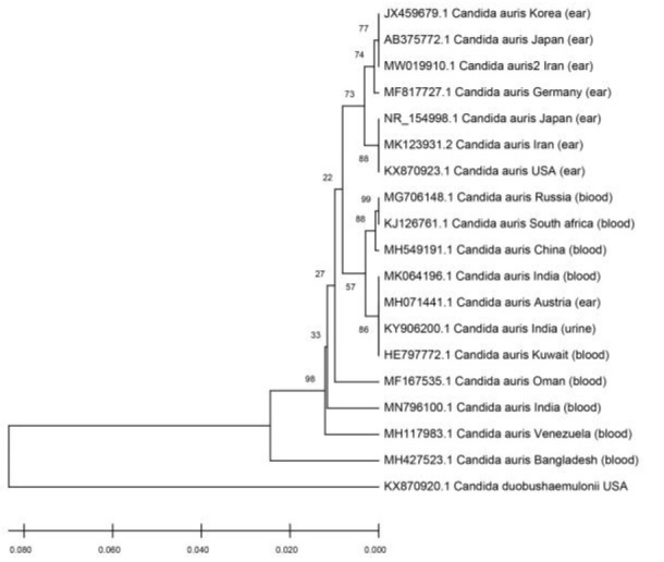 First fluconazole-resistant <i>Candida auris</i> isolated from fungal otitis in Iran.