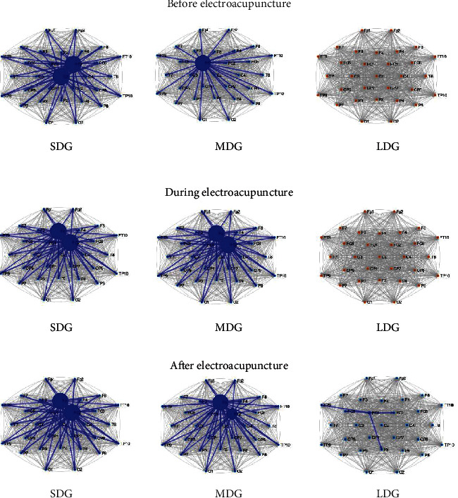 Weakened Effective Connectivity Related to Electroacupuncture in Stroke Patients with Prolonged Flaccid Paralysis: An EEG Pilot Study.