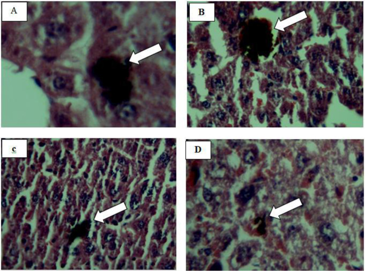 The Effect of Different Doses of Mesobuthus eupeus (Scorpionida: Buthidae) Scorpion Venom on the Production of Liver Necrosis in Nmri Mice.