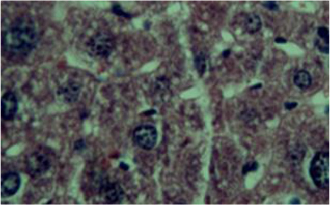 The Effect of Different Doses of Mesobuthus eupeus (Scorpionida: Buthidae) Scorpion Venom on the Production of Liver Necrosis in Nmri Mice.