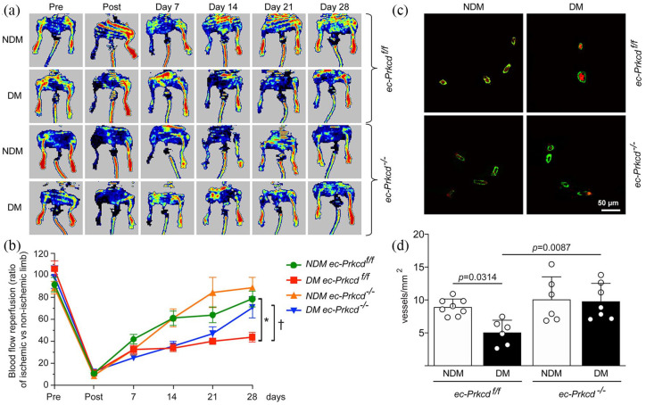 Endothelial deletion of PKCδ prevents VEGF inhibition and restores blood flow reperfusion in diabetic ischemic limb.