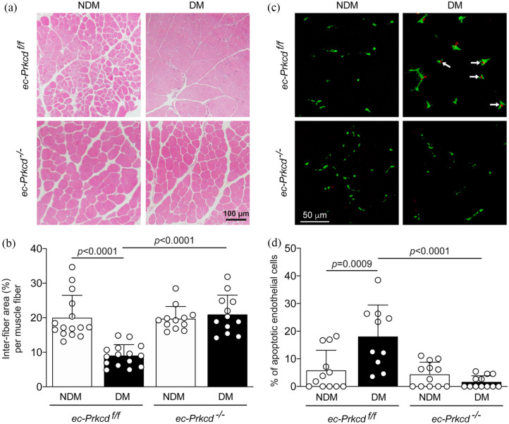 Endothelial deletion of PKCδ prevents VEGF inhibition and restores blood flow reperfusion in diabetic ischemic limb.