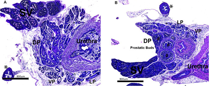 The helix-loop-helix transcriptional regulator Id4 is required for terminal differentiation of luminal epithelial cells in the prostate.