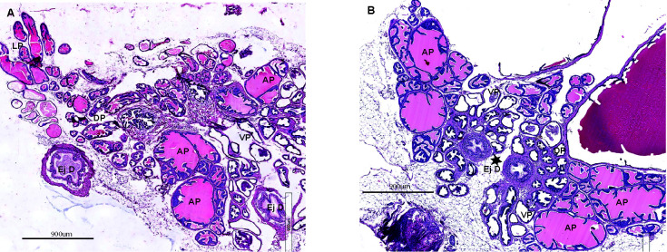 The helix-loop-helix transcriptional regulator Id4 is required for terminal differentiation of luminal epithelial cells in the prostate.