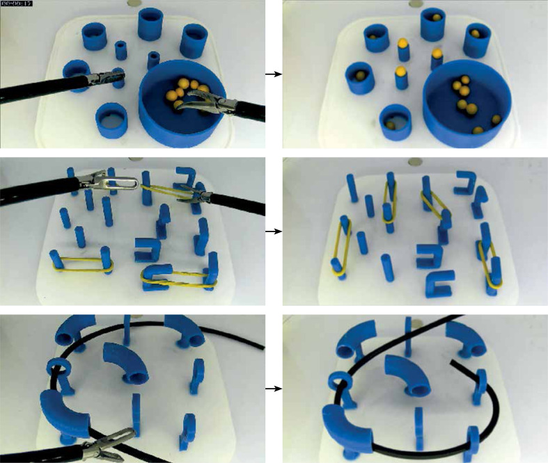 Assessment of training and selected factors on speed and quality of performing different tasks on the endoscopic simulator.