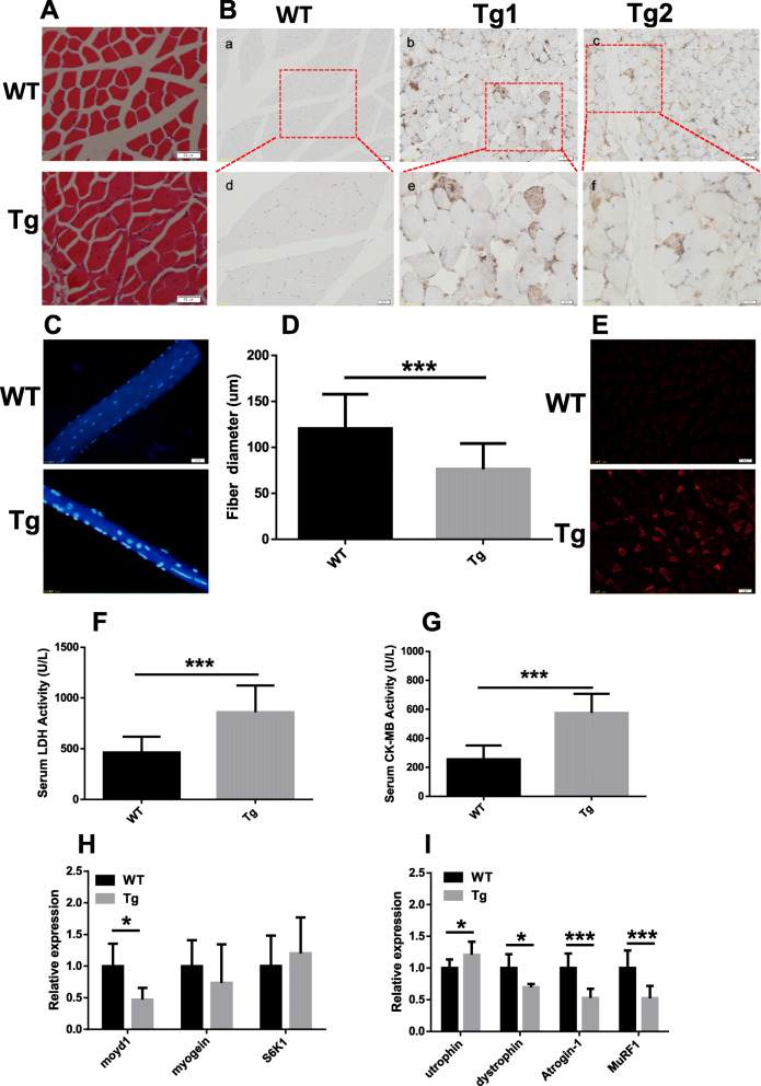 Muscle atrophy induced by overexpression of ALAS2 is related to muscle mitochondrial dysfunction.