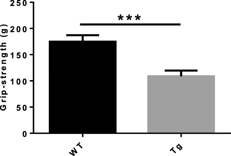 Muscle atrophy induced by overexpression of ALAS2 is related to muscle mitochondrial dysfunction.