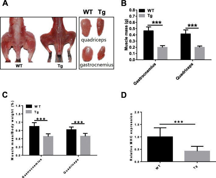 Muscle atrophy induced by overexpression of ALAS2 is related to muscle mitochondrial dysfunction.