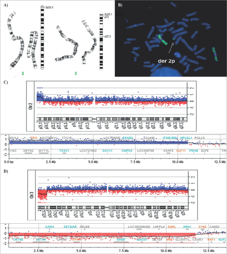 Fetal Cystic Hygroma Associated with Terminal 2p25.1 Duplication and Terminal 3p25.3 Deletion: Cytogenetic, Fluorescent <i>in Situ</i> Hybridization and Microarray Familial Characterization of Two Different Chromosomal Structural Rearrangements.