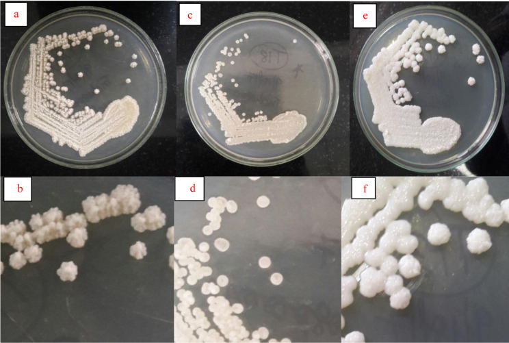 Epidemiological profile and antifungal susceptibility pattern of <i>Trichosporon</i> species in a tertiary care hospital in Chandigarh, India.