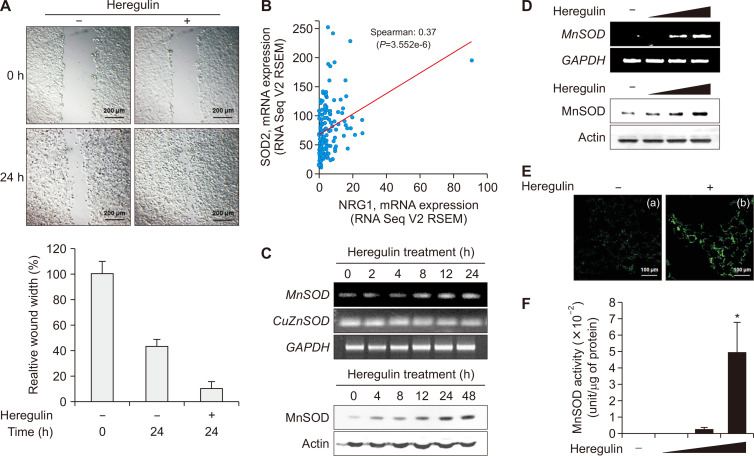 Heregulin-β1 Activates NF-E2-related Factor 2 and Induces Manganese Superoxide Dismutase Expression in Human Breast Cancer Cells via Protein Kinase B and Extracellular Signal-regulated Protein Kinase Signaling Pathways.