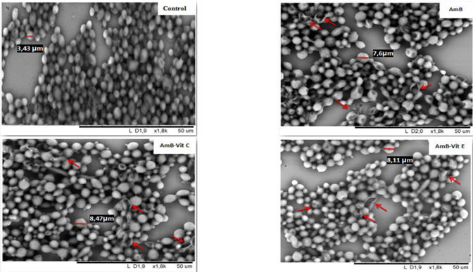 Influence of ascorbic acid and α-tocopherol on the autoxidation and in vitro antifungal activity of amphotericin B.