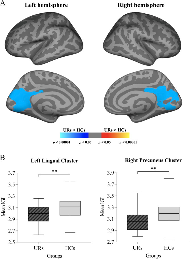 Reduced cortical gyrification in the posteromedial cortex in unaffected relatives of schizophrenia patients with high genetic loading.