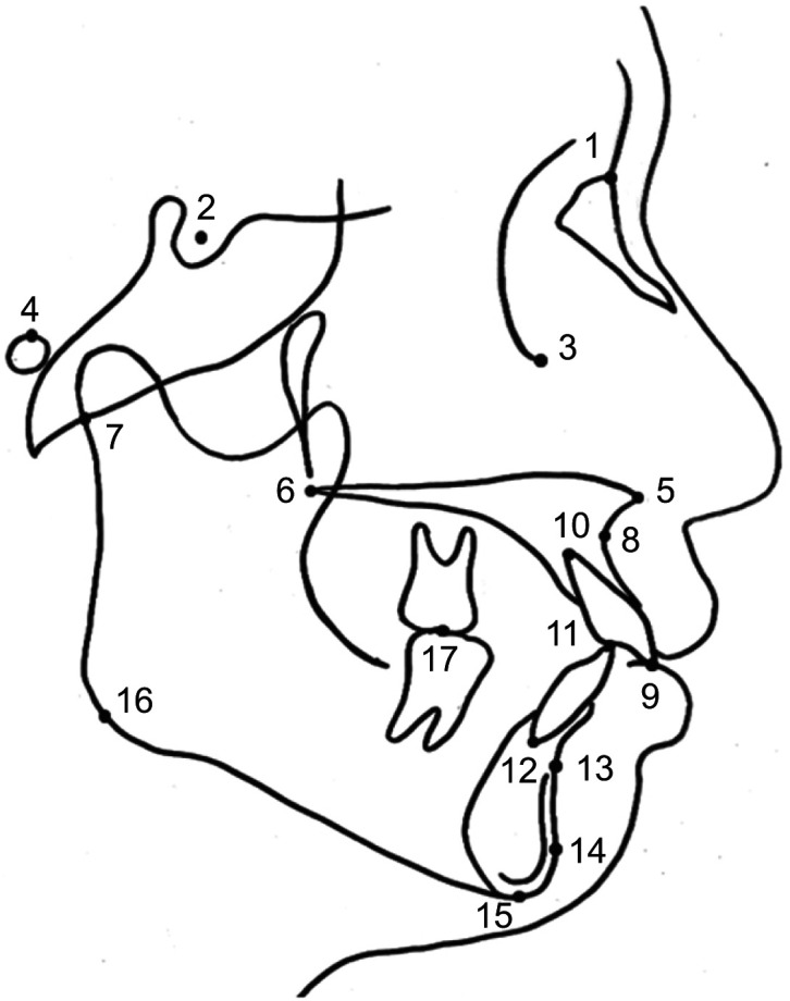 Relationship between rotational disc displacement of the temporomandibular joint and the dentoskeletal morphology.