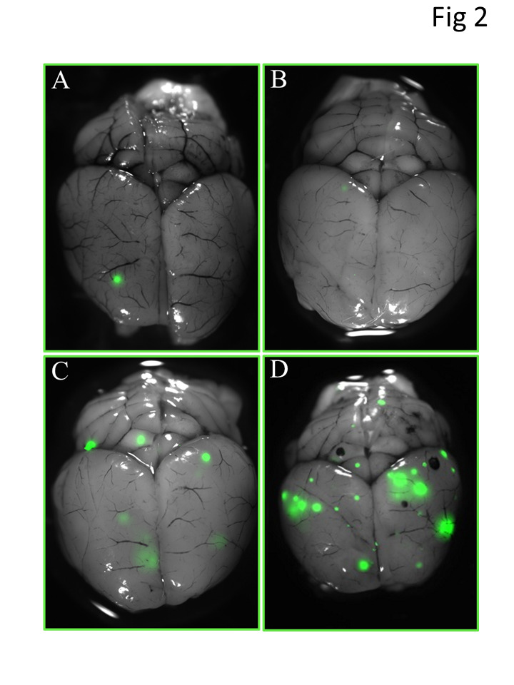 Prophylactic cranial irradiation reduces the incidence of brain metastasis in a mouse model of metastatic, HER2-positive breast cancer.