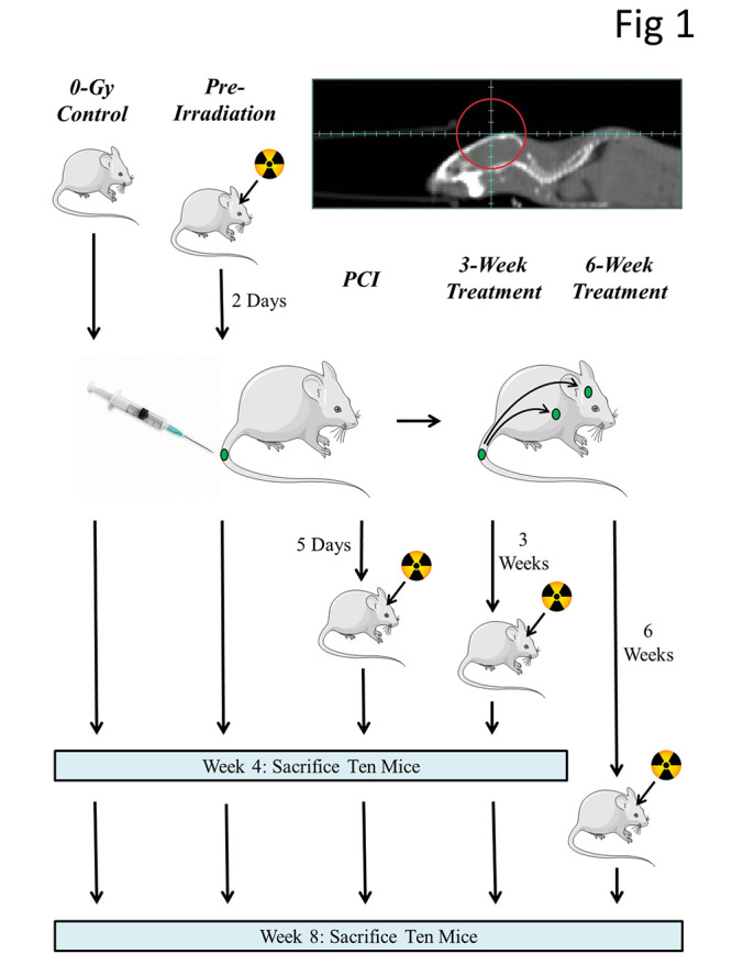 Prophylactic cranial irradiation reduces the incidence of brain metastasis in a mouse model of metastatic, HER2-positive breast cancer.