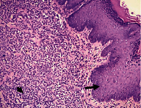 Polymicrobial Necrotizing Fasciitis in a Dog: The Involvement of <i>Macrococcus caseolyticus</i>, <i>Proteus mirabilis</i>, and <i>Escherichia coli</i>.