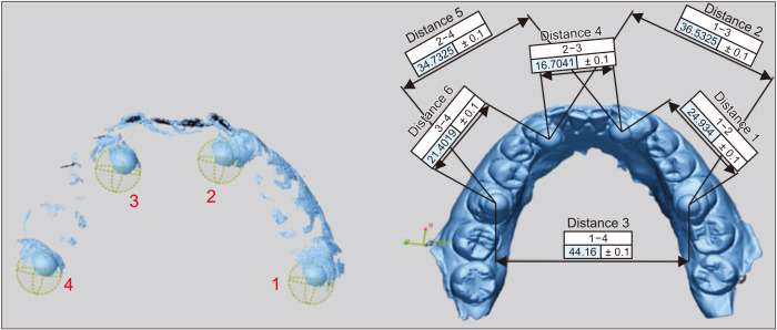 Full-arch accuracy of five intraoral scanners: <i>In vivo</i> analysis of trueness and precision.