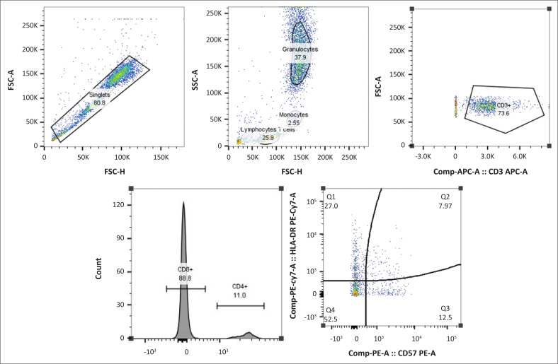 Immune activation and arterial stiffness in lean adults with HIV on antiretroviral therapy.