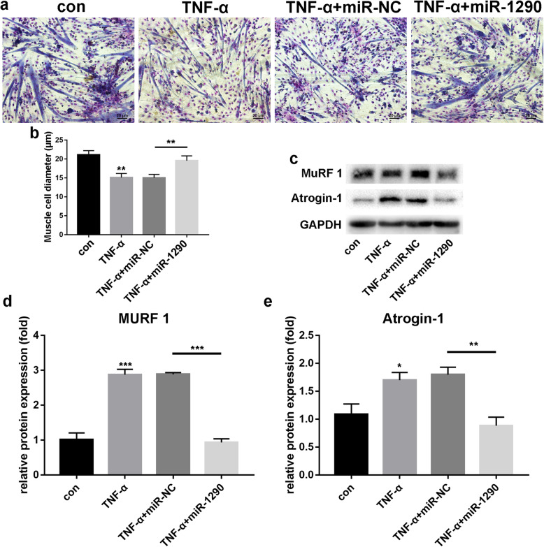 MiR-1290 promotes myoblast differentiation and protects against myotube atrophy via Akt/p70/FoxO3 pathway regulation.