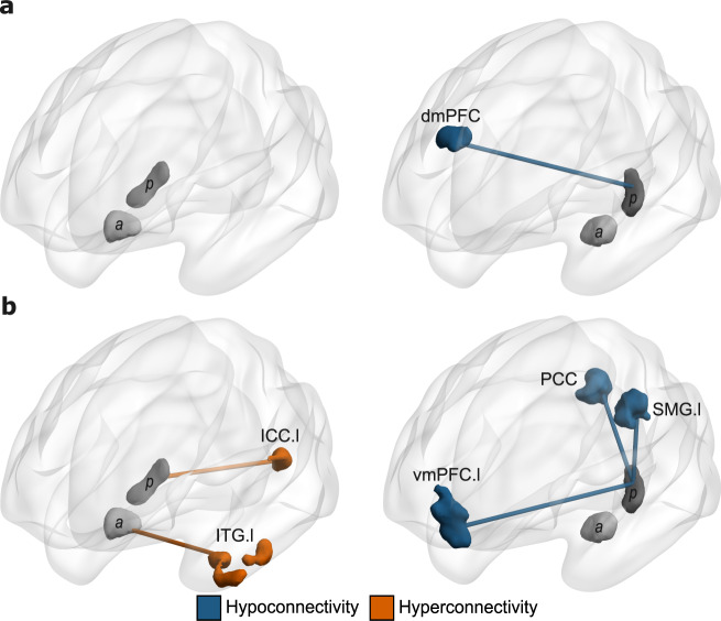 Functional connectivity abnormalities of the long-axis hippocampal subregions in schizophrenia during episodic memory.