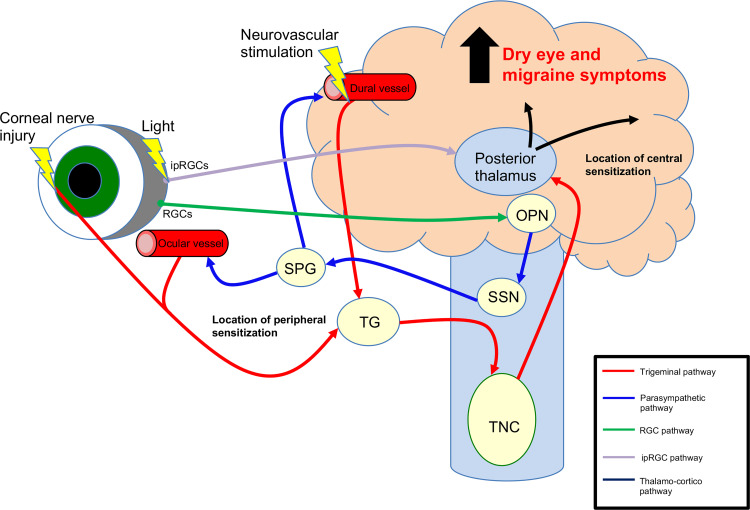 Exploring the Link Between Dry Eye and Migraine: From Eye to Brain.