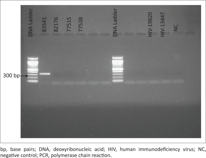 HIV-1/2 differentiation in a South African public laboratory.