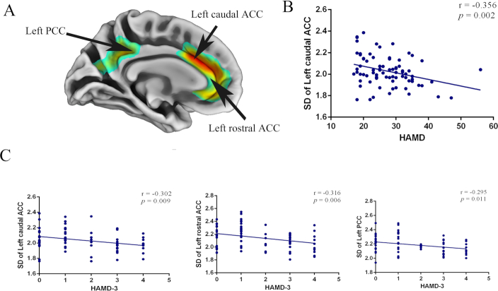 Altered cortical morphology in major depression disorder patients with suicidality.